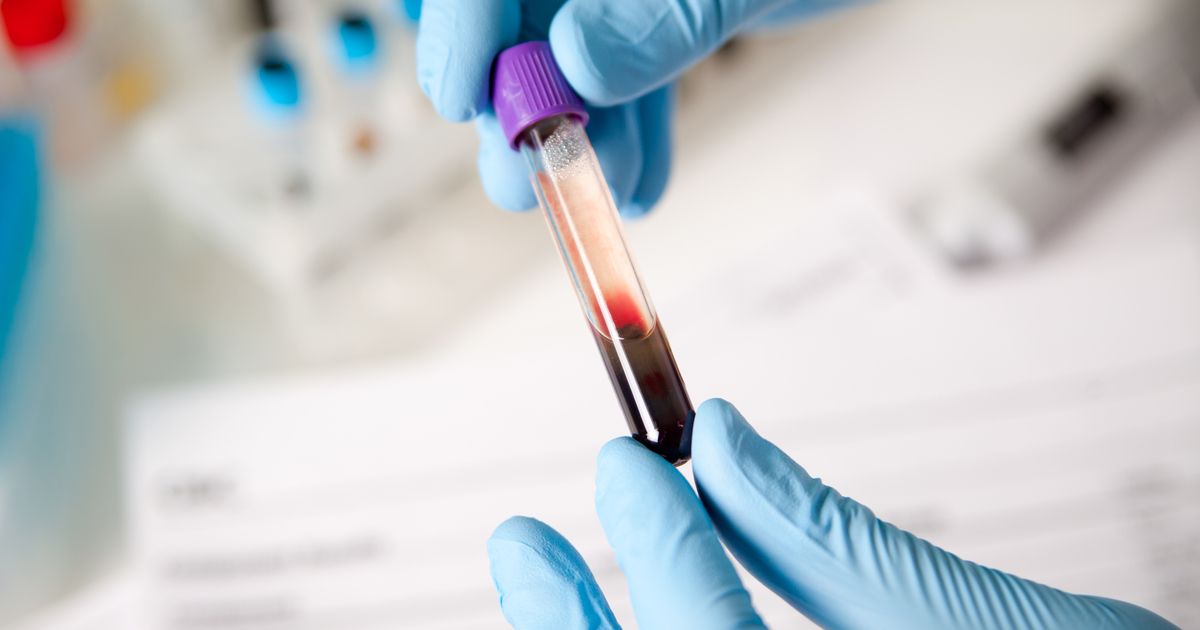 German Team Develops MALDI Assay for Rapid Blood Culture Susceptibility ...