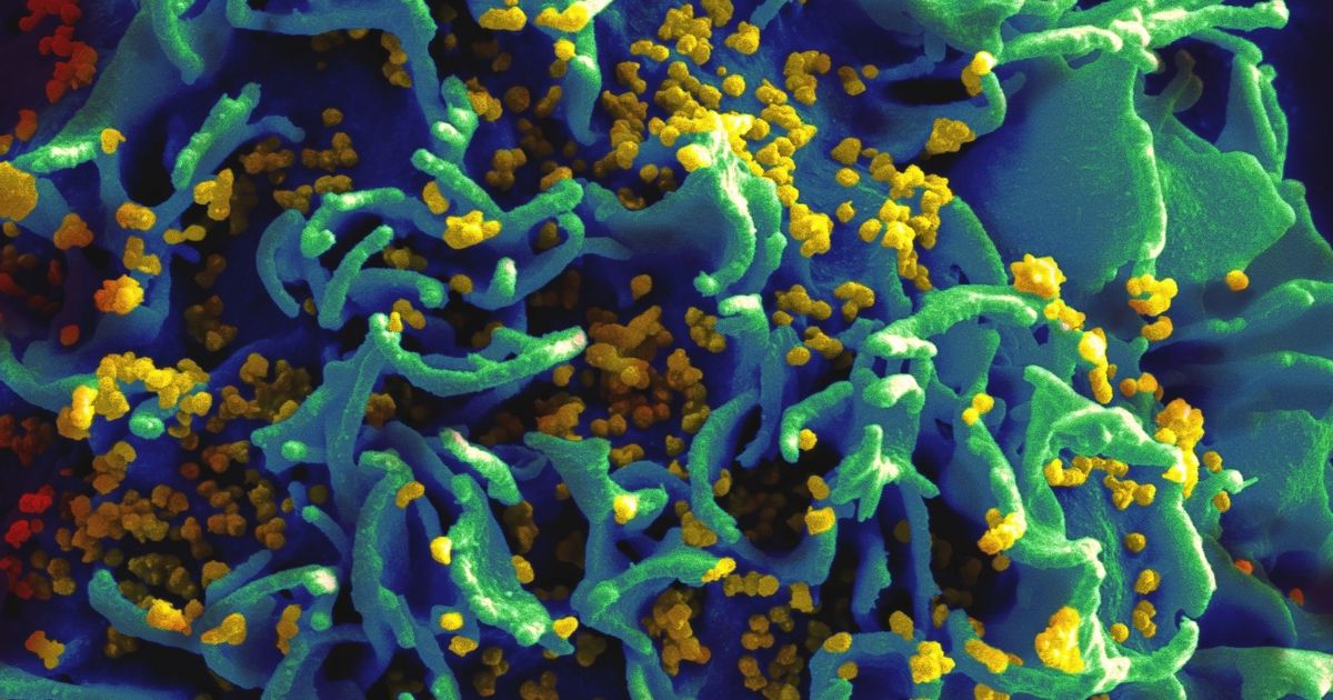 Aldatu Biosciences Wins SBIR Grant to Advance MDx Detecting HIV