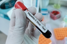 HepatitisCVirusTest.jpeg