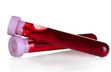Taking too long to process a blood sample could corrupt test results.