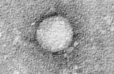 Electron micrographs of hepatitis C virus purified from cell culture