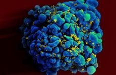 HIV-infected T cell