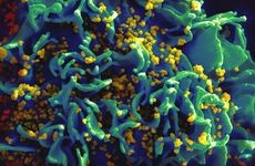 Scanning electron micrograph of HIV particles infecting a human T cell.