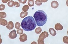 Micrograph of Giemsa-stained monocytes, a type of white blood cell