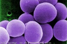 Staphylococcus aureus bacteria