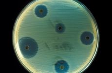 Staphylococcus aureus