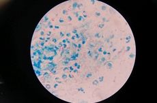 Mycobacterium tuberculosis