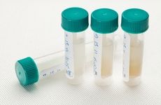 Vials of saliva