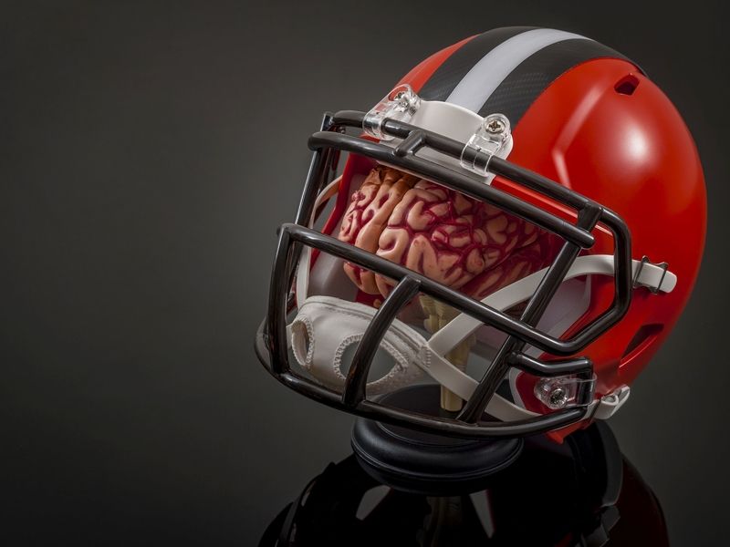 TechKnow 110: Diagnosing and treating football players' concussions