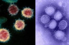 SARS-Flu